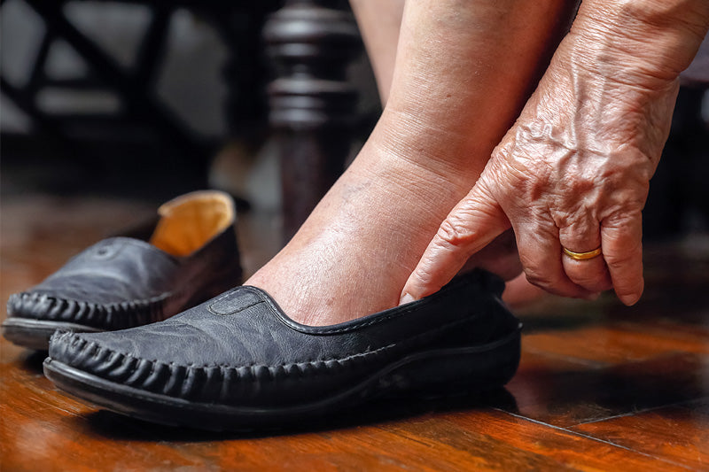 An elderly woman wears her diabetic shoes, supporting foot health